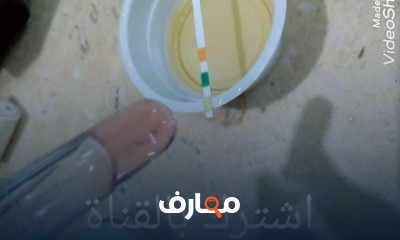 قراءة تحليل السائل المنوى