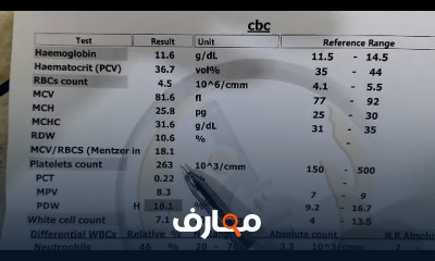 كيفية قراءة التحاليل الطبية