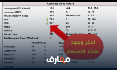 قراءة تحليل الدهون الكاملة