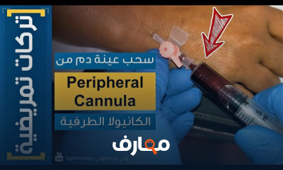 سحب عينة دم من الكانيولا الطرفية