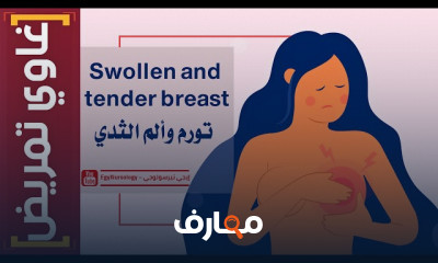 تشخيص حالات تورم وألم الثدي