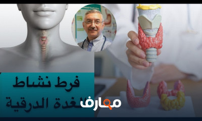 فرط نشاط الغدة الدرقية