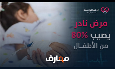 أسباب مرض كاواساكي