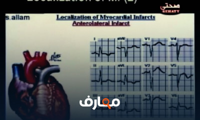 مبادئ تخطيط القلب الكهربائي