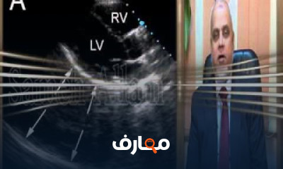 كيفية استخدام جهاز الإيكو للقلب