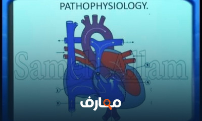 أساسيات أمراض القلب الخلقية