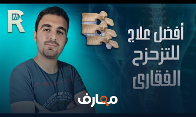 علاج تزحزح وإنزلاق الفقرات