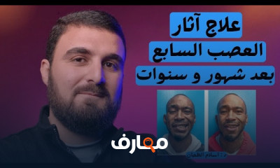 علاج العصب السابع