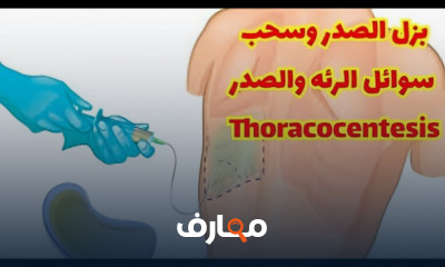 طريقة بزل الجنب وسحب سائل الرئة