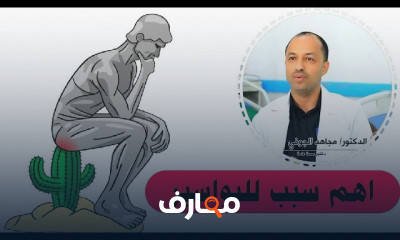 علاج البواسير hemorrhoids علاج البواسير hemorrhoids