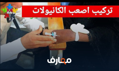 طريقة تركيب الكانيولا