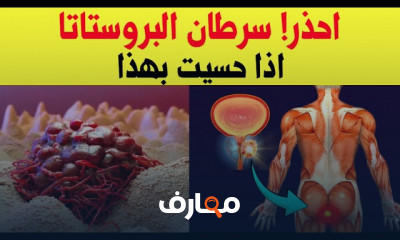 أعراض إلتهابات سرطان البروستاتا