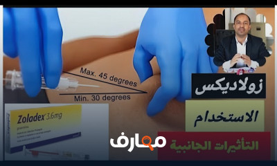 أعراض العلاج الكيماوي