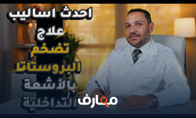 علاج دوالي الساقين