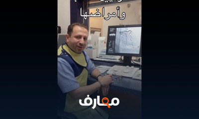 علاج تضيق الشرايين بالقسطرة