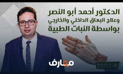 علاج البهاق الداخي والخارجي