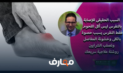 علاج النقرس بالأعشاب