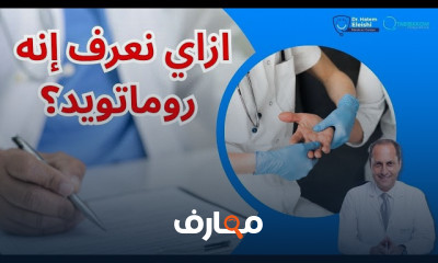 تشخيص الروماتويد المفصلي