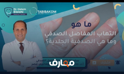 أعراض التهاب المفاصل الصدفي