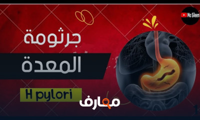 تحاليل جرثومة المعدة