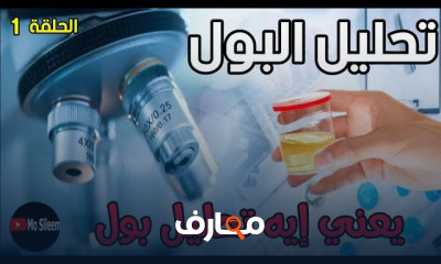 تحليل البول الكامل