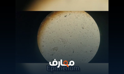 تحليل البول