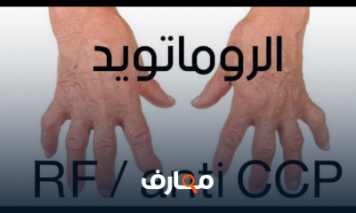 تشخيص التهاب مفاصل الروماتويدي