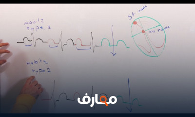 أساسيات تخطيط القلب ECG