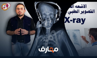 كيفية قراءة صور الأشعة X ray