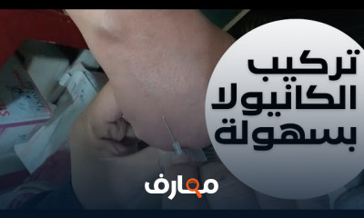 طريقة تركيب الكانيولا للأورده