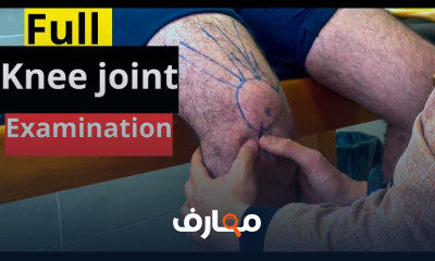 تمارين لتقوية الركبة