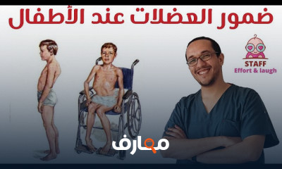 ضمور العضلات عند الأطفال