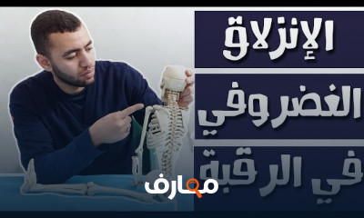 تمارين علاج آلام وغضروف الرقبة