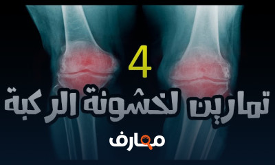 تمارين علاج خشونة مفصل الركبة
