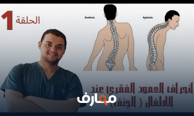 انحراف العمود الفقري للأطفال