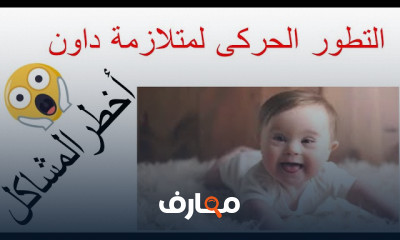 علاج طبيعى لأطفال متلازمة داون