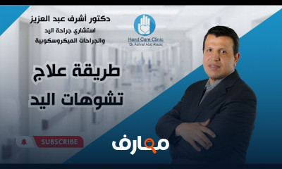 طريقة علاج تشوهات اليد