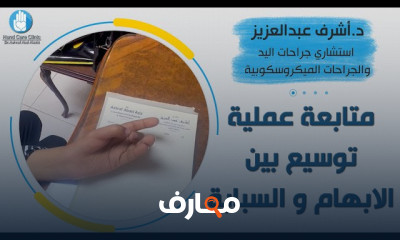 أسباب تضخم اصابع اليد