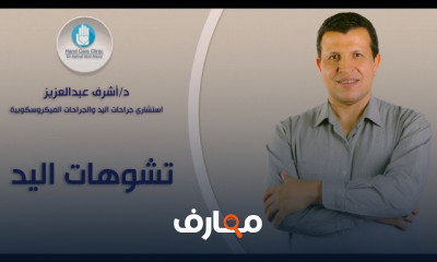 تشوهات اليد عند الأطفال