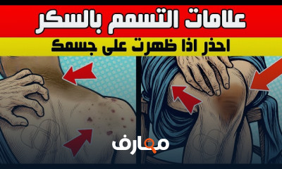 علاج تورم الكاحل والقدمين