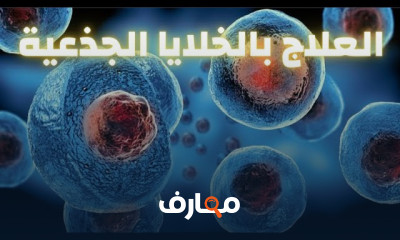 علاج شوكة الكعب العظمية