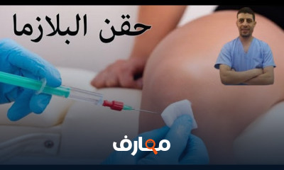 تمارين علاج تقوس الساقين