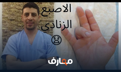 أسباب تنميل اليدين وطرق العلاج