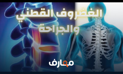 أسباب شوكة الكعب العظمية