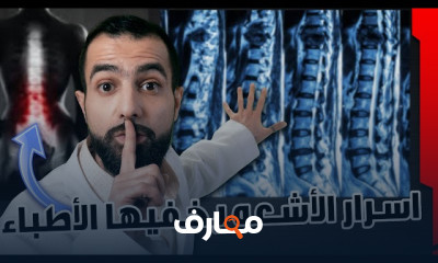 قراءة الرنين والأشعة MRI