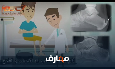 أسباب وجع الكعب وآلم القدم