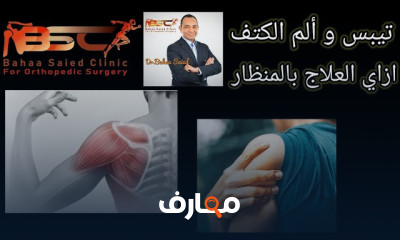 علاج تيبس وألم الكتف