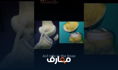 أسباب اصابة الرباط الصليبي