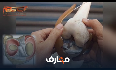 علاج آلم وخشونة الركبة