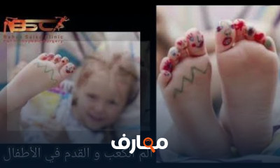 آلام القدم والكعب للأطفال